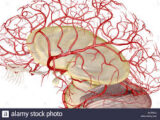 Sintomi neuropsichiatrici associati alla malattia dei piccoli vasi cerebrali: una revisione sistematica e una meta-analisi